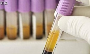 实践价值阐释 —— 差异化监管如何 “提效能、促发展”