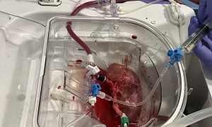 科学家首次将人肾类器官与猪肾实现功能整合，为器官量产及移植带来新希望